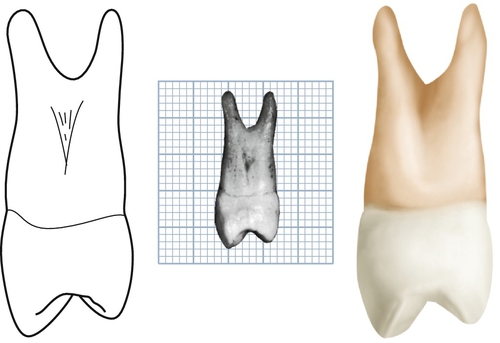Wheeler’S Dental Anatomy, Physiology, and Occlusion