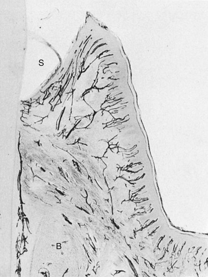 Carranza's Clinical Periodontology