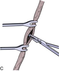 Care of the Patient With a Urinary Disorder