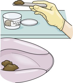 Specimen Collection and Diagnostic Testing