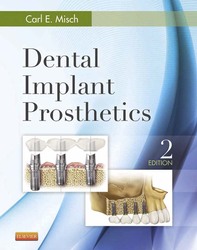 Dental Implant Prosthetics