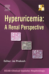 Hyperuricemia: A Renal Perspective - ECAB