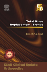 Total Knee Replacement: Trends - ECAB