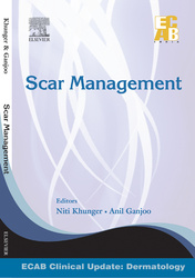 Scar Management - ECAB