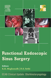 Functional Endoscopic Sinus Surgery - ECAB