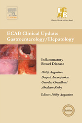 Inflammatory Bowel Diseases - ECAB