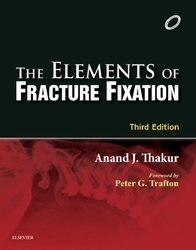 Elements of Fracture Fixation