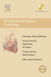 Coronary Artery Disease - ECAB