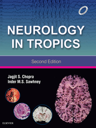 Neurology in Tropics (E-book)