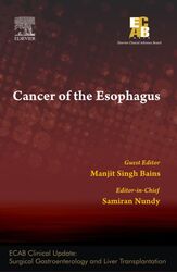 Cancer of the Esophagus - ECAB