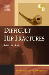 ECAB Difficult Hip Fracture