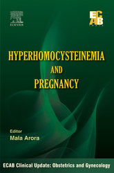 Hyperhomocysteinemia and Pregnancy - ECAB